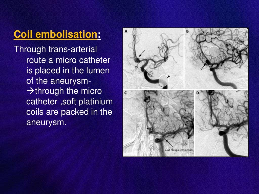 Anatomy and intervention in cerebral vasculature