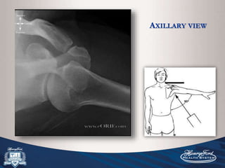 Normal Axillary View Anatomy and physical exam of the shoulder | PPTX