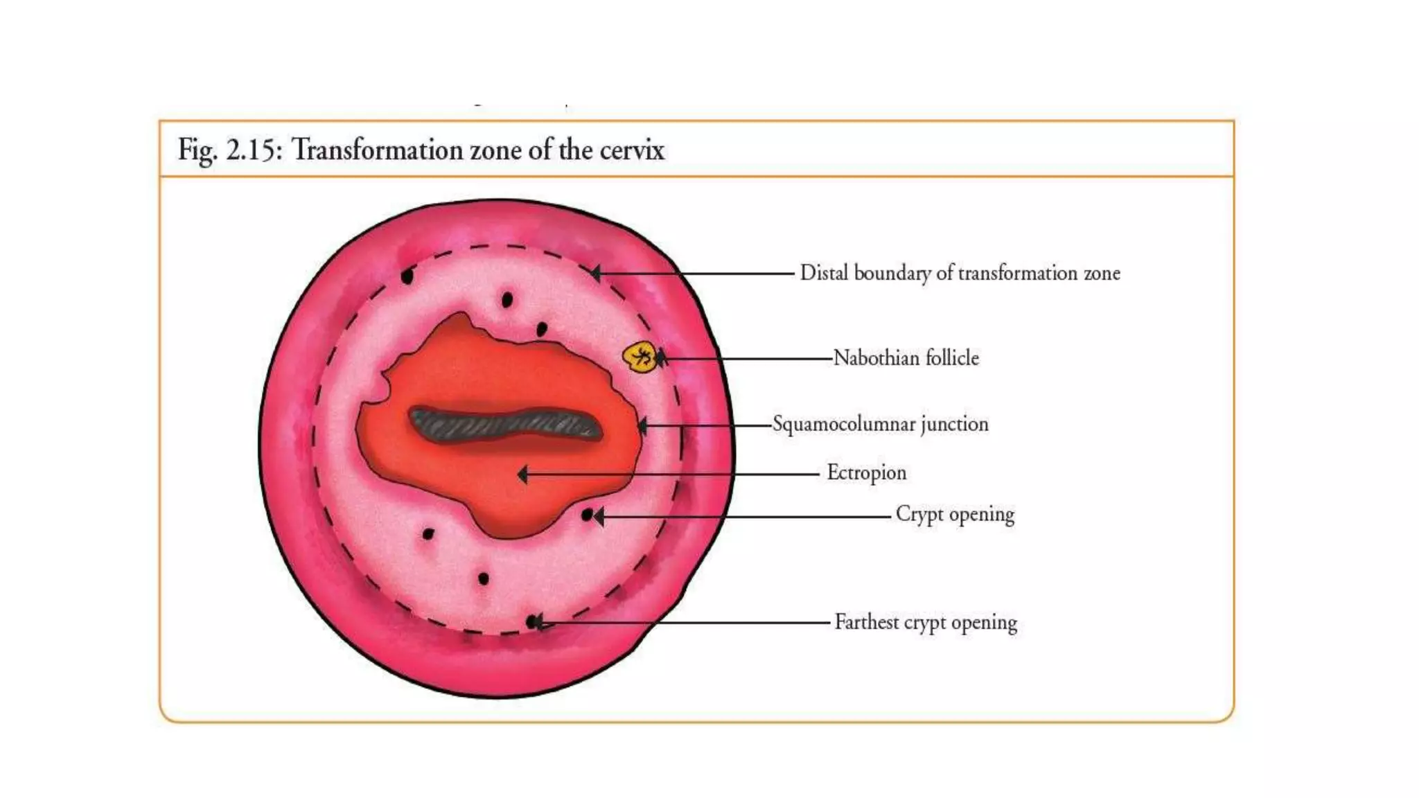 Anatomy And Physiology Of Cervix pptx Anatomy And Physiology Of Cervix pptx