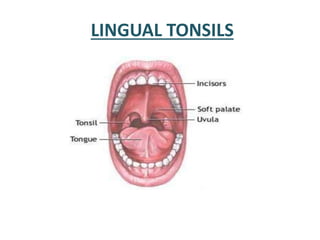 LINGUAL TONSILS
 