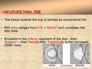 Peripheric Rim Location Anatomy and Physiology of Optic Nerve Dr.PrabhatDevkota.pptx