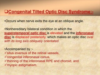 Anatomy and Physiology of Optic Nerve Dr.PrabhatDevkota.pptx