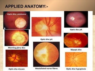 Anatomy and Physiology of Optic Nerve Dr.Prabhat_78d818a0-c8b5-4cb0 ...