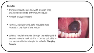 Anatomy and physiology of salivary glands | PPTX