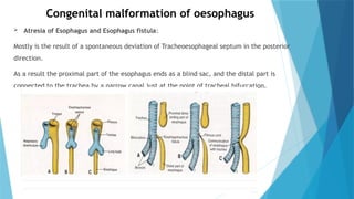 Comprehensive Overview of Esophagus Anatomy and Physiology with ...