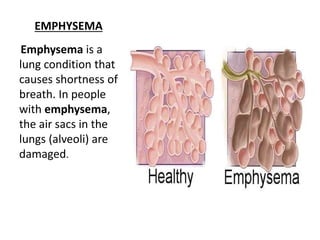 Anatomy and physiology of the respiratory system | PPTX