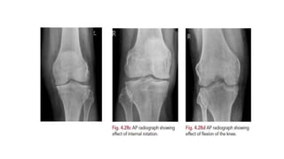 ANATOMY AND POSITIONING OF KNEE.pptx