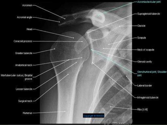 Anatomy and Radiography of shoulder and arm