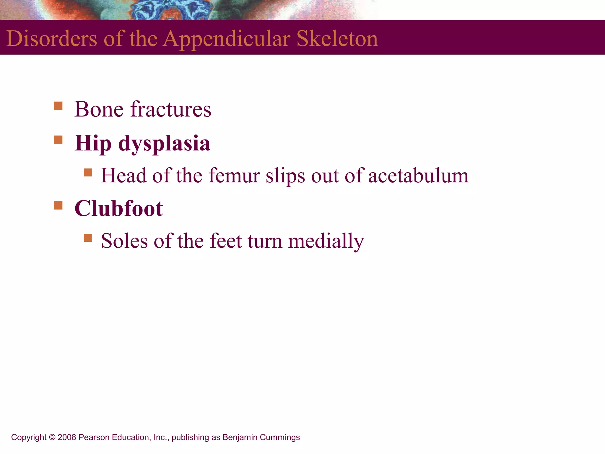 Copyright © 2008 Pearson Education, Inc., publishing as Benjamin Cummings
Disorders of the Appendicular Skeleton
 Bone fractures
 Hip dysplasia
 Head of the femur slips out of acetabulum
 Clubfoot
 Soles of the feet turn medially
 