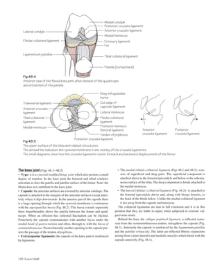 110 Lower limb
• The medial (tibial) collateral ligament (Figs 48.1 and 48.3)acon-
sists of superﬁcial and deep parts. The superﬁcial component is
attached above to the femoral epicondyle and below to the subcuta-
neous surface of the tibia. The deep component is ﬁrmly attached to
the medial meniscus.
• The lateral (ﬁbular) collateral ligament (Fig. 48.2)ais attached to
the femoral epicondyle above and, along with biceps femoris, to
the head of the ﬁbula below. Unlike the medial collateral ligament
it lies away from the capsule and meniscus.
The collateral ligaments are taut in full extension and it is in this
position that they are liable to injury when subjected to extreme val-
gus/varus strain.
Behind the knee the oblique popliteal ligament, a reﬂected exten-
sion from the semimembranosus tendon, strengthens the capsule (Fig.
48.3). Anteriorly the capsule is reinforced by the ligamentum patellae
and the patellar retinacula. The latter are reﬂected ﬁbrous expansions
arising from vastus lateralis and medialis muscles which blend with the
capsule anteriorly (Fig. 48.1).
The knee joint (Figs 48.1–48.5)
• Type: it is a synovial modiﬁed hinge joint which also permits a small
degree of rotation. In the knee joint the femoral and tibial condyles
articulate as does the patella and patellar surface of the femur. Note: the
ﬁbula does not contribute to the knee joint.
• Capsule: the articular surfaces are covered by articular cartilage. The
capsule is attached to the margins of the articular surfaces except anter-
iorly where it dips downwards. In the anterior part of the capsule there
is a large opening through which the synovial membrane is continuous
with the suprapatellar bursa (Fig. 48.2). This bursa extends superiorly
three ﬁngerbreadths above the patella between the femur and quad-
riceps. When an effusion has collected ﬂuctuation can be elicited.
Posteriorly the capsule communicates with another bursa under the
medial head of gastrocnemius and often, through it, with the bursa of
semimembranosus. Posterolaterally another opening in the capsule per-
mits the passage of the tendon of popliteus.
• Extracapsular ligaments: the capsule of the knee joint is reinforced
by ligaments.
Fig.48.4
Anterior view of the flexed knee joint after division of the quadriceps
and retraction of the patella
Fig.48.5
The upper surface of the tibia and related structures.
The dotted line indicates the synovial membrane in the vicinity of the cruciate ligaments.
The small diagrams show how the cruciate ligaments resist forward and backward displacement of the femur
Lateral condyle
Fibular collateral ligament
Ligamentum patellae
Medial meniscus
Patella (turned back)
Tibial collateral ligament
Fat
Coronary ligament
Medial meniscus
Anterior cruciate ligament
Posterior cruciate ligament
Medial condyle
Deep infrapatellar
bursa
Cut edge of
capsular ligament
Lateral meniscus
Fibular collateral
ligament
Posterior menisco-
femoral ligament
Tendon of popliteus
Posterior cruciate ligament
Anterior
cruciate ligament
Posterior
cruciate ligament
Tibial collateral
ligament
Anterior cruciate
ligament
Transverse ligament
 
