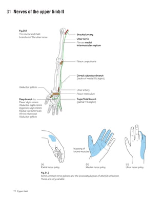Dorsal cutaneous branch
(backs of medial 11/2 digits)
Fig.31.1
The course and main
branches of the ulnar nerve
Fig.31.2
Some common nerve palsies and the associated areas of altered sensation.
These are very variable
Brachial artery
Ulnar nerve
Flexor carpi ulnaris
Flexor retinculum
Adductor pollicis
Deep branch to;
Flexor digiti minimi
Abductor digiti minimi
Opponens digit minimi
Medial two lumbricals
All the interossei
Adductor pollicis
Superficial branch
(palmar 11/2 digits)
Ulnar artery
(a)
Radial nerve palsy
(b)
Median nerve palsy
Wasting of
thumb muscles
(c)
Ulnar nerve palsy
Pierces medial
intermuscular septum
72 Upper limb
31 Nerves of the upper limb II
 