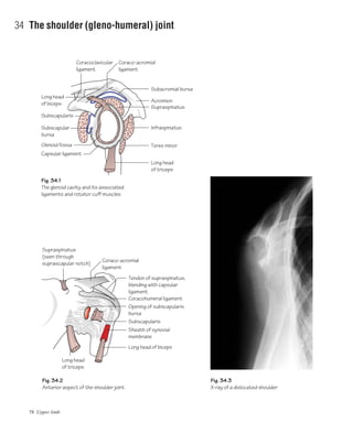 78 Upper limb
34 The shoulder (gleno-humeral) joint
Fig. 34.2
Anterior aspect of the shoulder joint
Fig. 34.3
X-ray of a dislocated shoulder
Fig. 34.1
The glenoid cavity and its associated
ligaments and rotator cuff muscles
Coracoclavicular
ligament
Supraspinatus
(seen through
suprascapular notch)
Coraco-acromial
ligament
Acromion
Supraspinatus
Coraco-acromial
ligament
Subacromial bursa
Tendon of supraspinatus,
blending with capsular
ligament
Coracohumeral ligament
Subscapularis
Sheath of synovial
membrane
Long head of biceps
Opening of subscapularis
bursa
Infraspinatus
Teres minor
Long head
of triceps
Long head
of triceps
Long head
of biceps
Subscapularis
Subscapular
bursa
Glenoid fossa
Capsular ligament
 