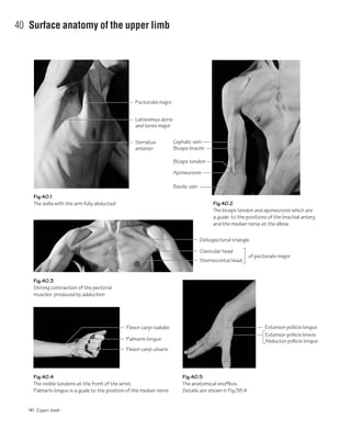 90 Upper limb
40 Surface anatomy of the upper limb
Fig.40.1
The axilla with the arm fully abducted Fig.40.2
The biceps tendon and aponeurosis which are
a guide to the positions of the brachial artery
and the median nerve at the elbow
Fig.40.3
Strong contraction of the pectoral
muscles produced by adduction
Fig.40.5
The anatomical snuffbox.
Details are shown in Fig.38.4
Fig.40.4
The visible tendons at the front of the wrist.
Palmaris longus is a guide to the position of the median nerve
Pectoralis major
Latissimus dorsi
and teres major
Clavicular head
Deltopectoral triangle
Sternocostal head
of pectoralis major
Extensor pollicis longus
Extensor pollicis brevis
Abductor pollicis longus
Serratus
anterior
Cephalic vein
Biceps brachii
Basilic vein
Flexor carpi radialis
Palmaris longus
Flexor carpi ulnaris
Biceps tendon
Aponeurosis
 