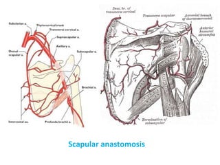 Scapular anastomosis
 