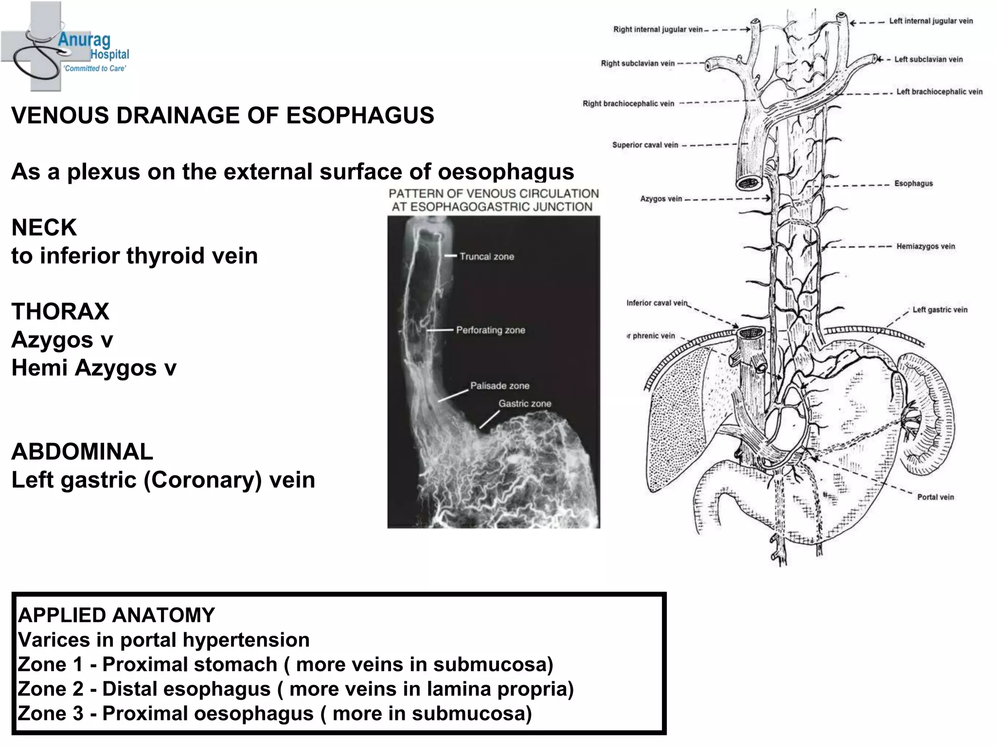 Surgical Anatomy of Esophagus | PPTX