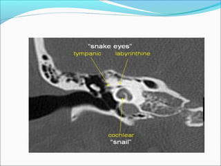 Anatomy facial nerve