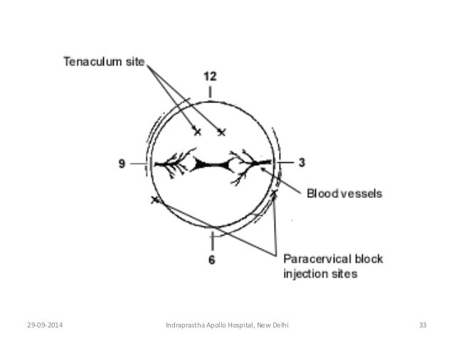 Image Result For Indraprastha Image Result For Indraprastha