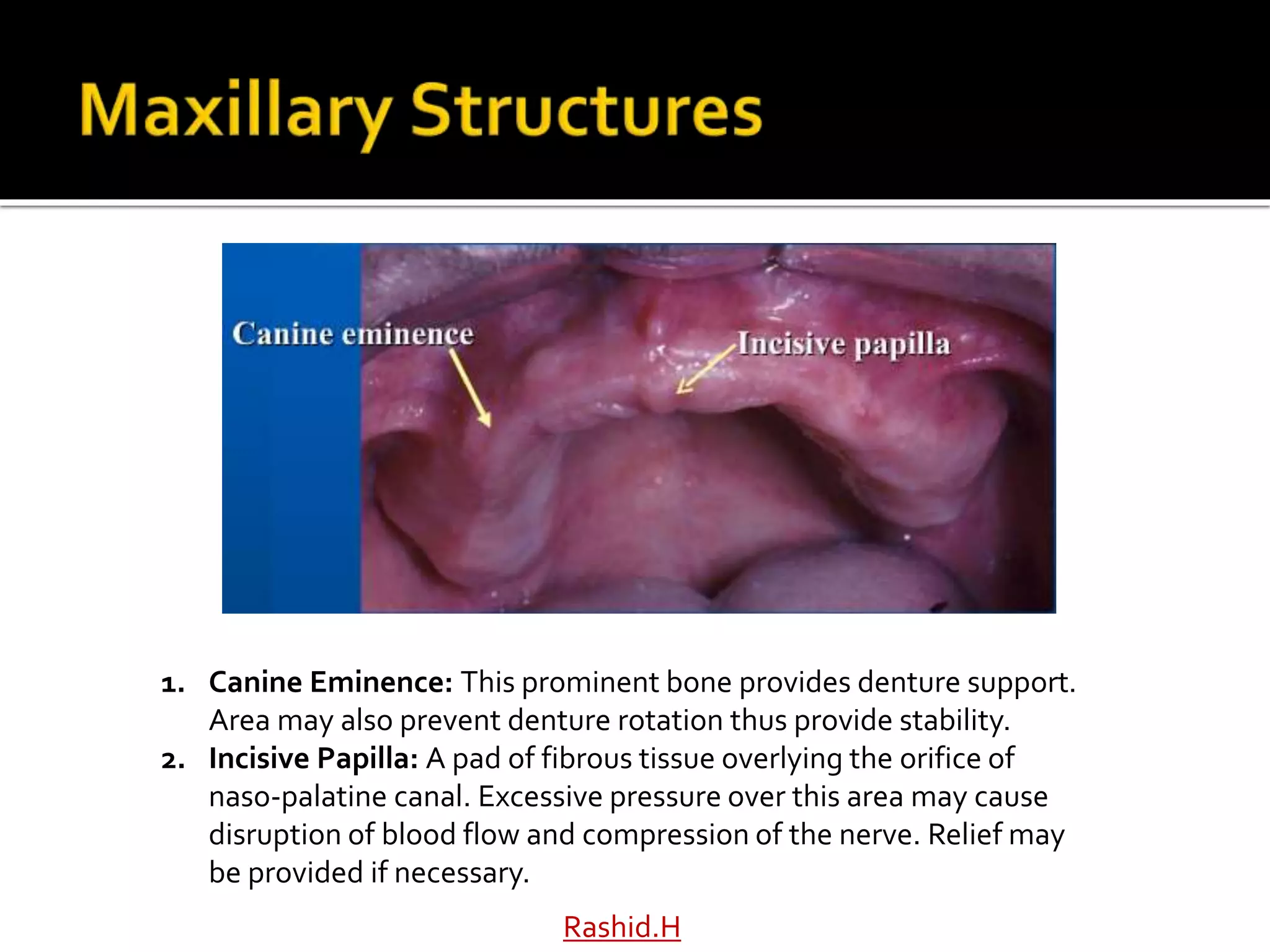 1. Canine Eminence: This prominent bone provides denture support.
Area may also prevent denture rotation thus provide stability.
2. Incisive Papilla: A pad of fibrous tissue overlying the orifice of
naso-palatine canal. Excessive pressure over this area may cause
disruption of blood flow and compression of the nerve. Relief may
be provided if necessary.
Rashid.H
 