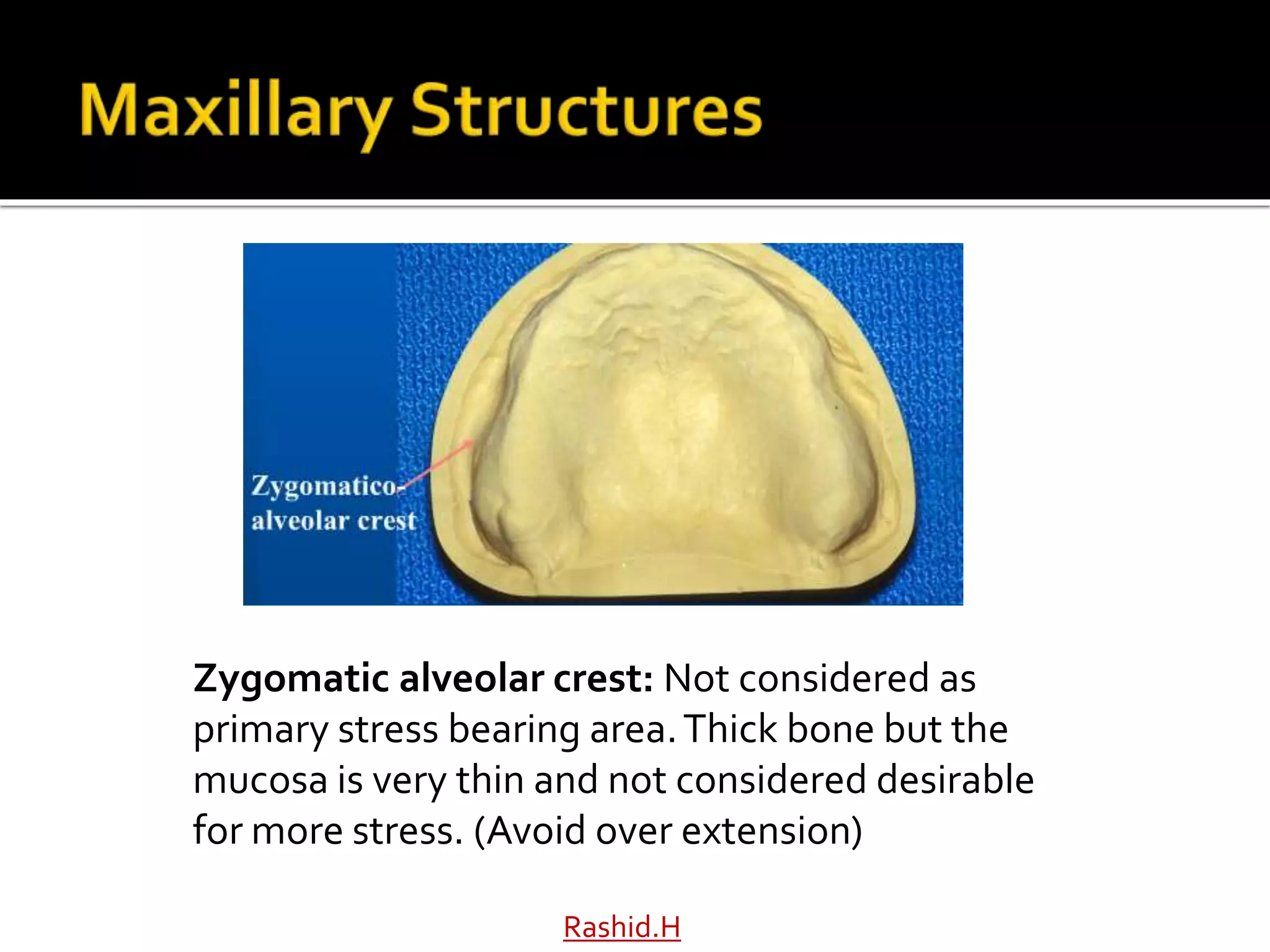 Rashid.H
Zygomatic alveolar crest: Not considered as
primary stress bearing area.Thick bone but the
mucosa is very thin and not considered desirable
for more stress. (Avoid over extension)
 
