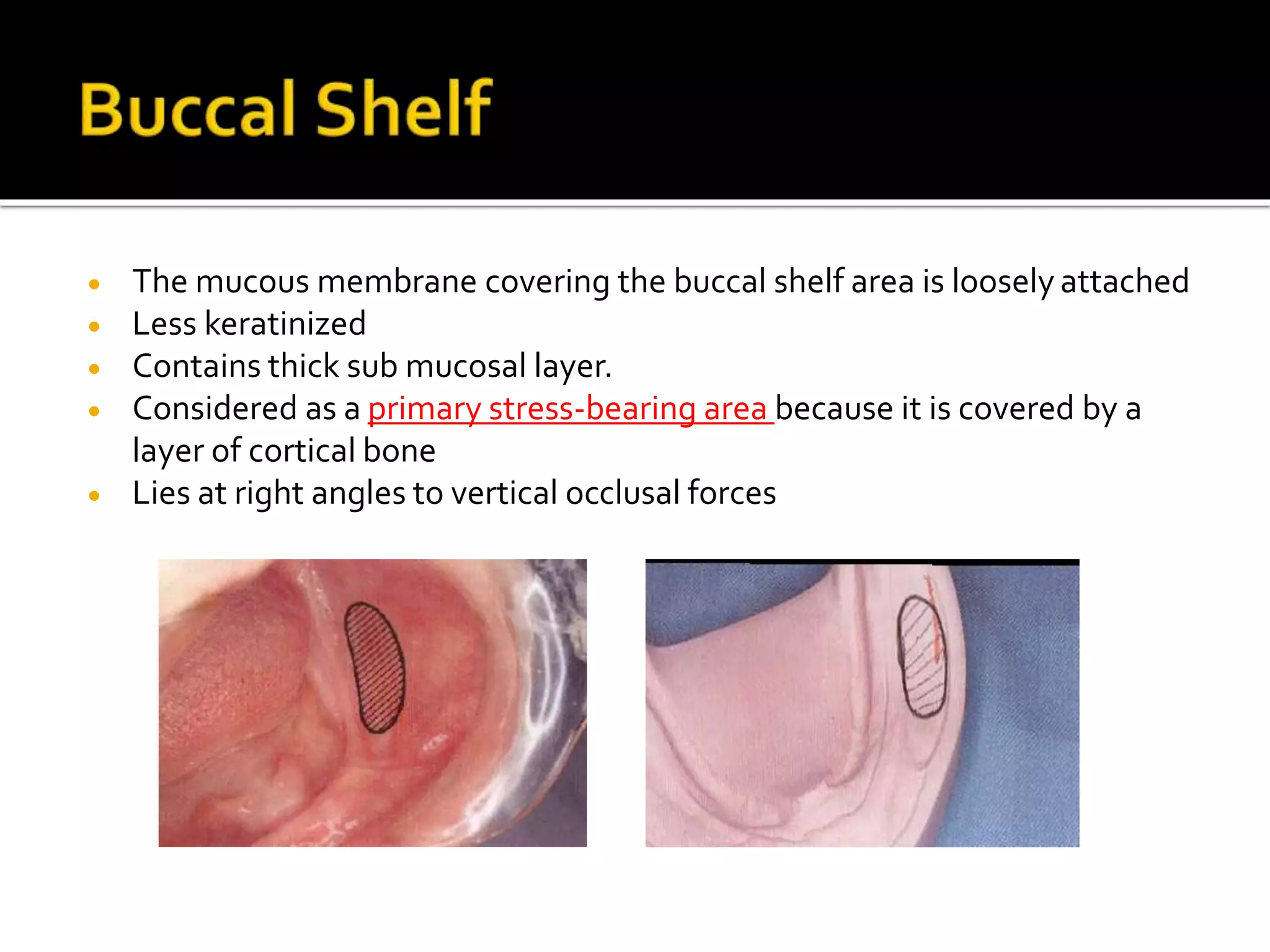  The mucous membrane covering the buccal shelf area is loosely attached
 Less keratinized
 Contains thick sub mucosal layer.
 Considered as a primary stress-bearing area because it is covered by a
layer of cortical bone
 Lies at right angles to vertical occlusal forces
 