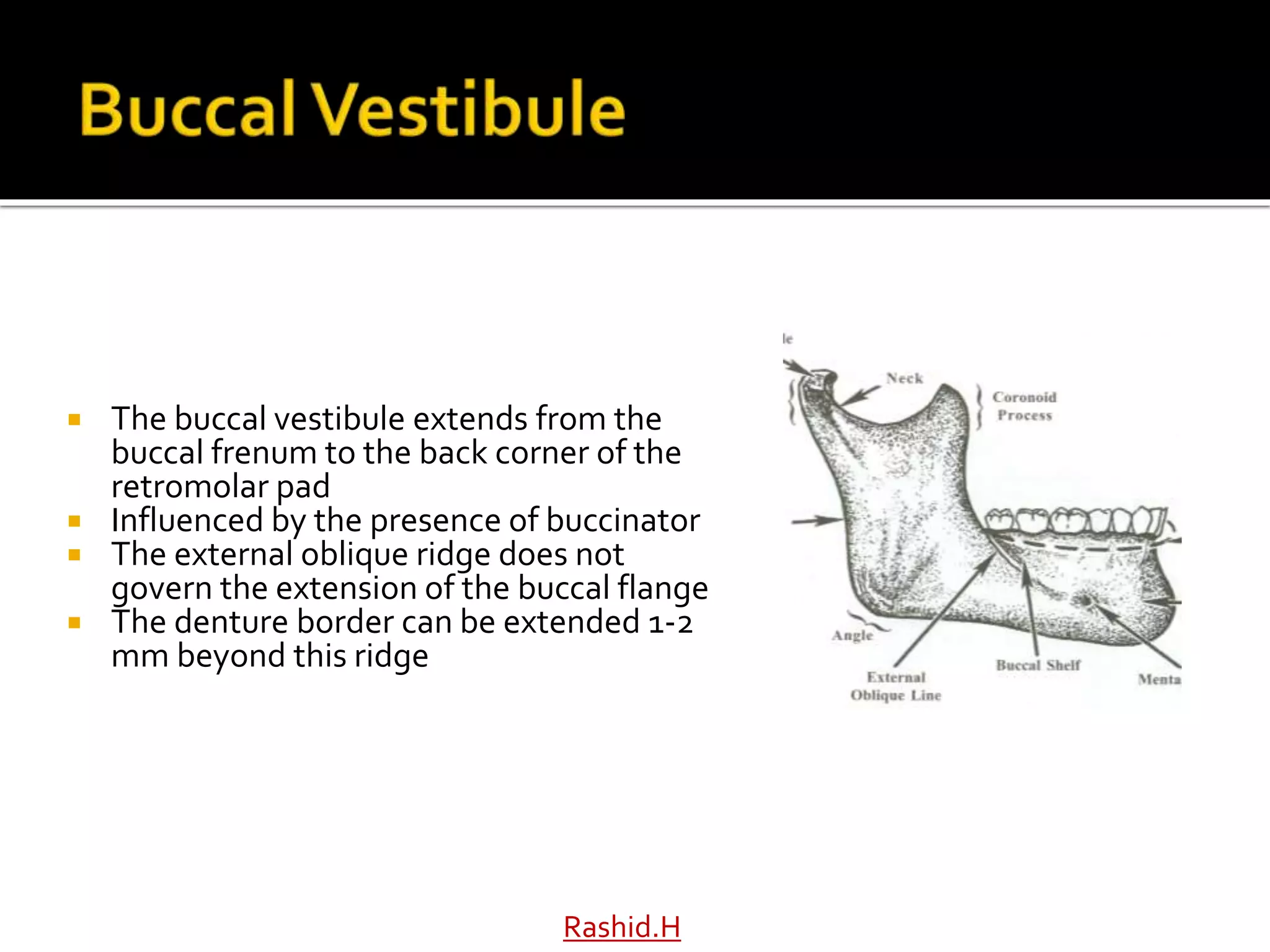  The buccal vestibule extends from the
buccal frenum to the back corner of the
retromolar pad
 Influenced by the presence of buccinator
 The external oblique ridge does not
govern the extension of the buccal flange
 The denture border can be extended 1-2
mm beyond this ridge
Rashid.H
 