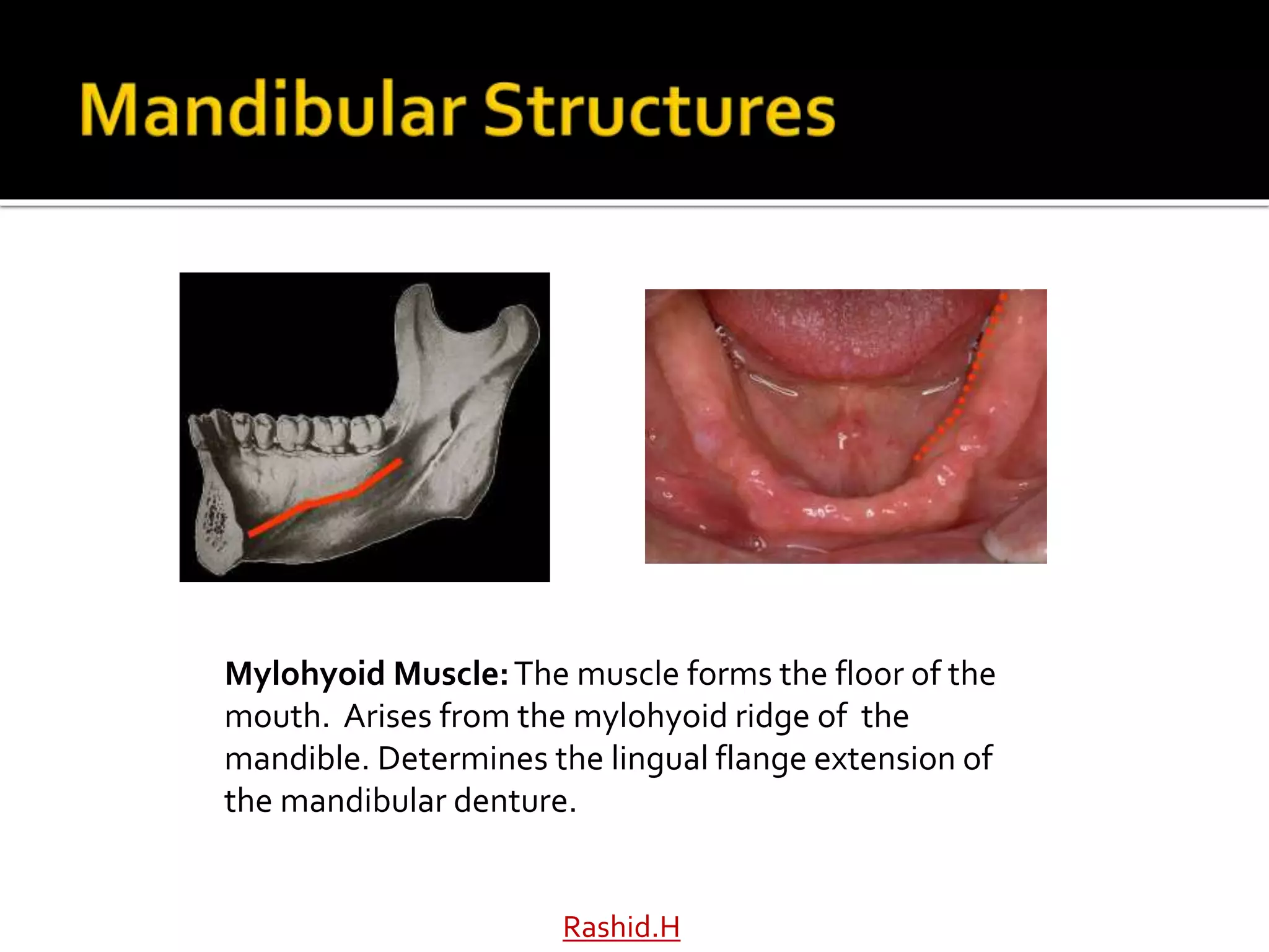 Rashid.H
Mylohyoid Muscle:The muscle forms the floor of the
mouth. Arises from the mylohyoid ridge of the
mandible. Determines the lingual flange extension of
the mandibular denture.
 