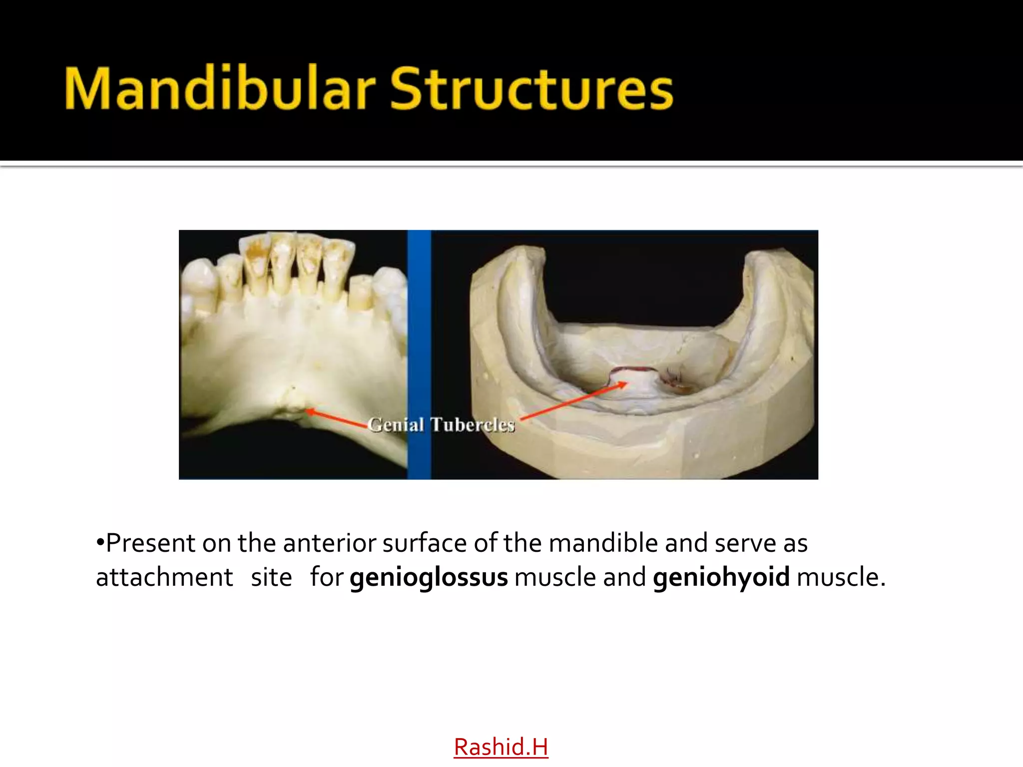 Rashid.H
•Present on the anterior surface of the mandible and serve as
attachment site for genioglossus muscle and geniohyoid muscle.
 
