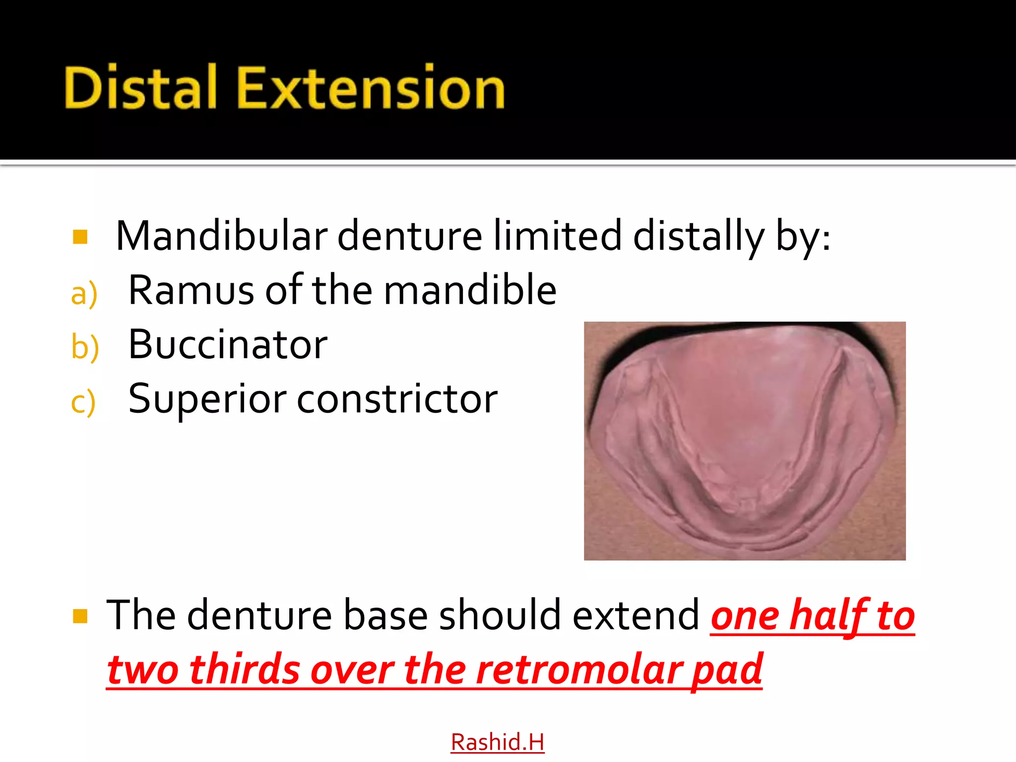  Mandibular denture limited distally by:
a) Ramus of the mandible
b) Buccinator
c) Superior constrictor
 The denture base should extend one half to
two thirds over the retromolar pad
Rashid.H
 