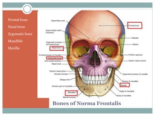Bones of Norma Frontalis
Frontal bone
Nasal bone
Zygomatic bone
Mandible
Maxilla
 