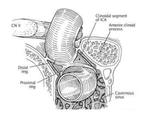 Interventional Neuroradiology: Anatomy of the internal carotid artery ...