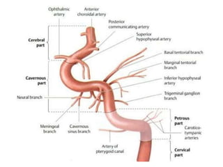 Interventional Neuroradiology: Anatomy of the internal carotid artery ...