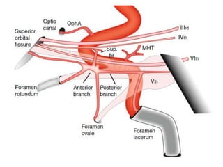 Interventional Neuroradiology: Anatomy of the internal carotid artery ...