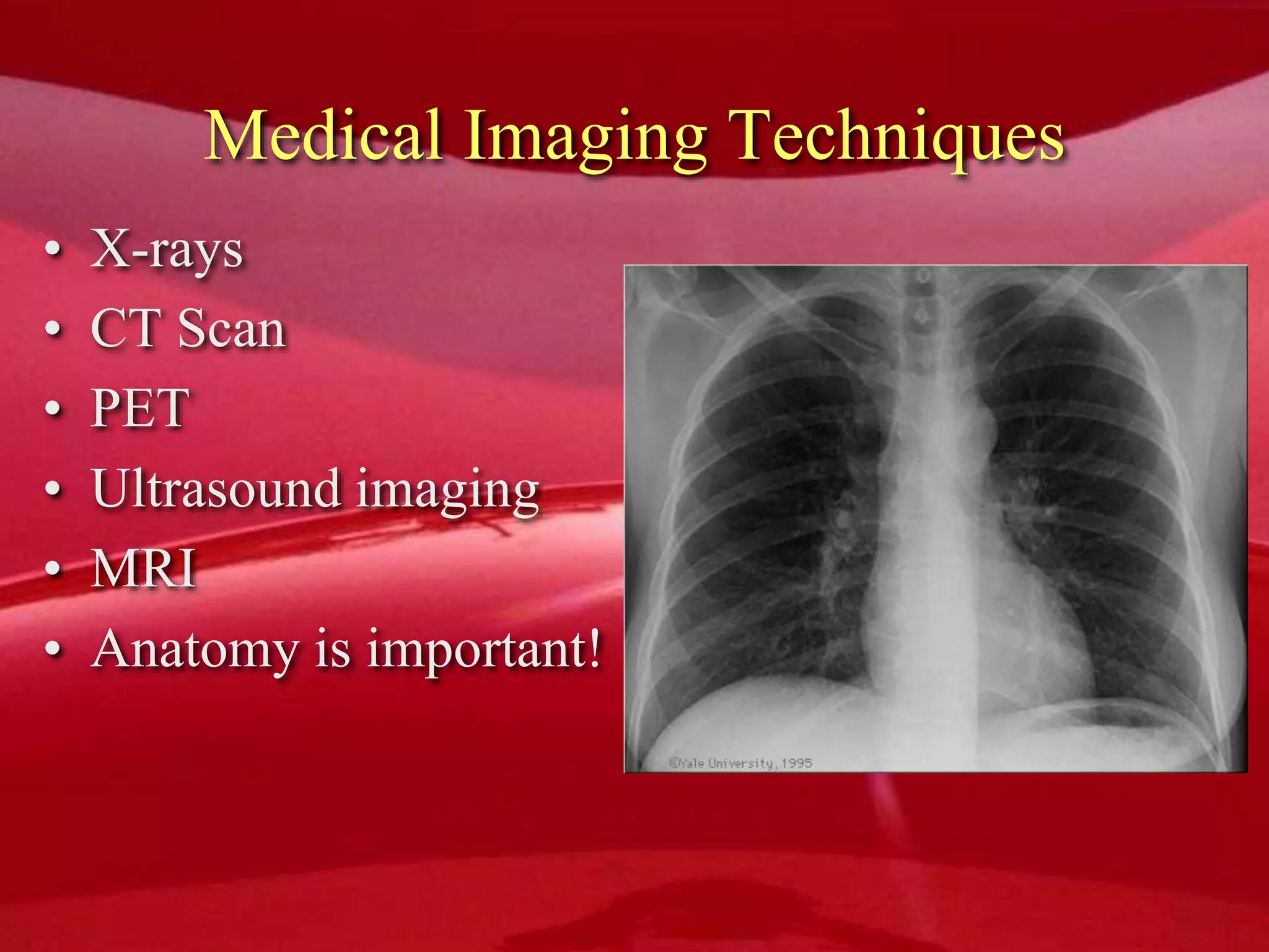 Medical Imaging Techniques
• X-rays
• CT Scan
• PET
• Ultrasound imaging
• MRI
• Anatomy is important!
 
