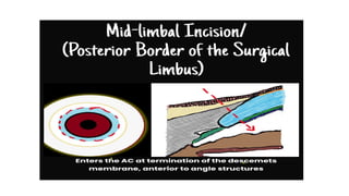 Limbus Lab COMPREHENSIVE OPHTHALMOLOGY UNIT ANATOMY LIMBUS NOTES | PPTX