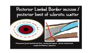 Limbus Lab ANATOMY LIMBUS comprehensive ophthalmology .pptx