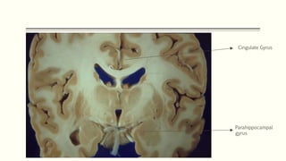 Cingulate Gyrus
Parahippocampal
gyrus
 