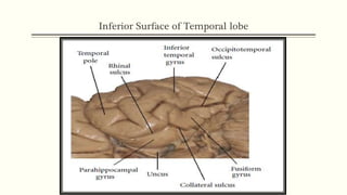 Inferior Surface of Temporal lobe
 