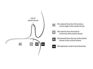 Anatomy of the middle cerebral artery (MCA) | PPT