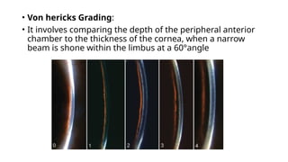 anatomy of ac and aqueous dynamics. pptx | PPTX