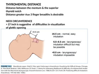 ANATOMY OF AIRWAY anesthesia, imortant.pptx