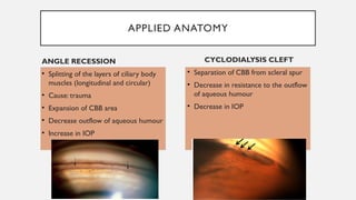 ANATOMY OF ANGLE OF ANTERIOR CHAMBER dr sanjana.pptx