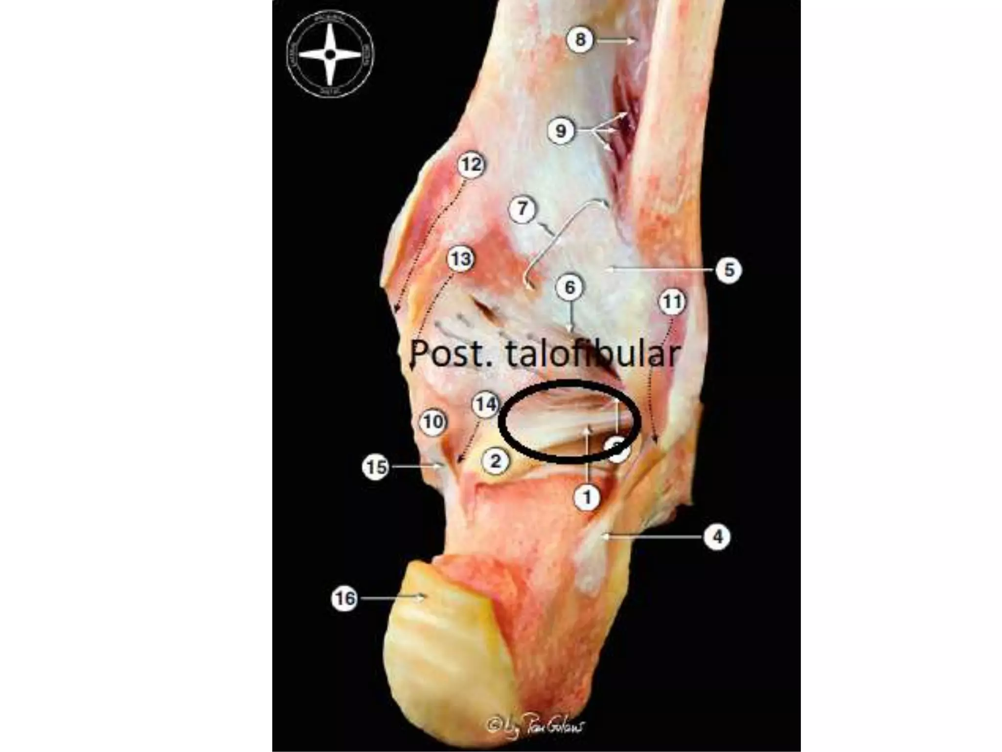 Anatomy of ankle joint | PPTX