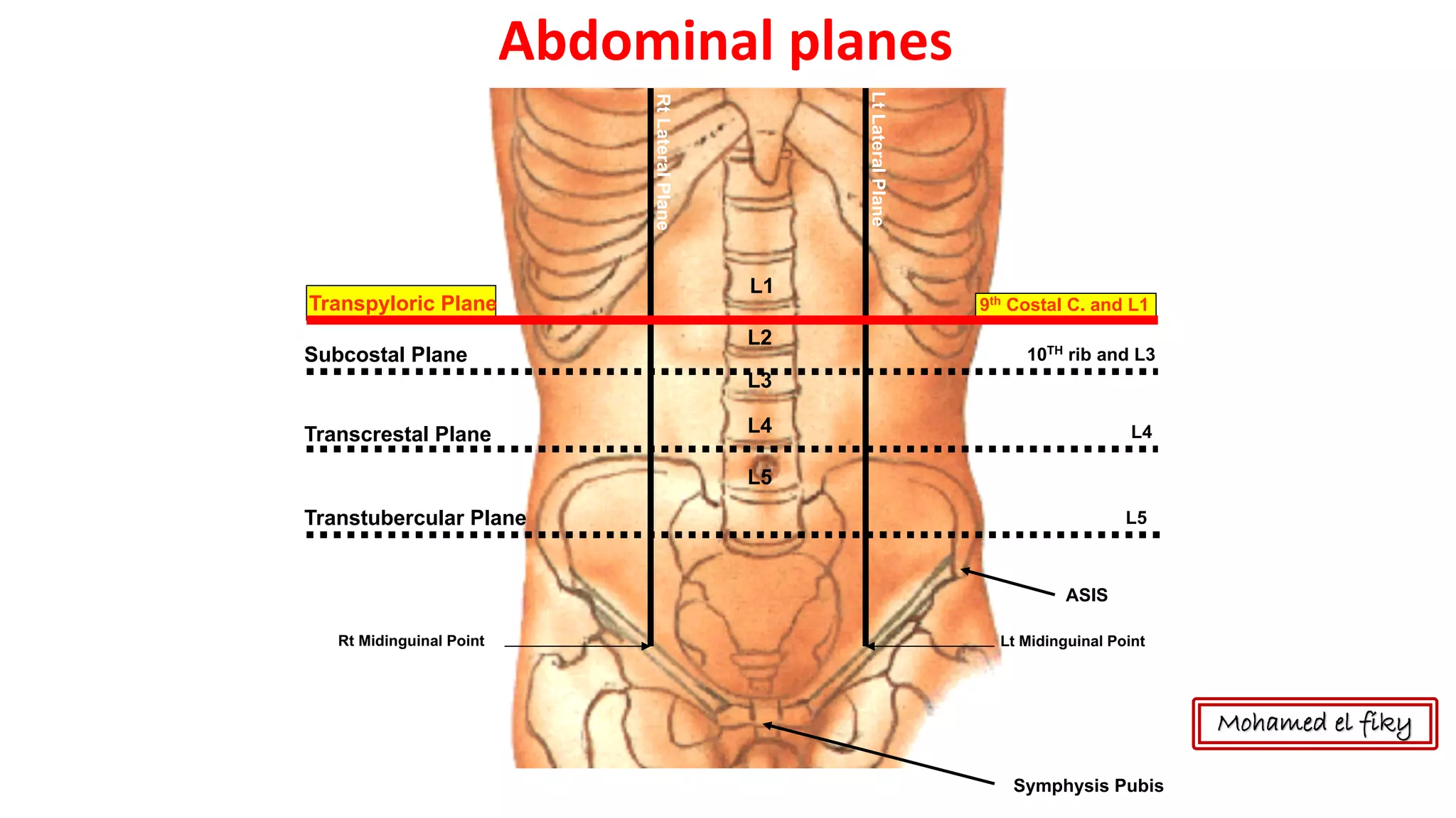 Abdominal Planes Diagram