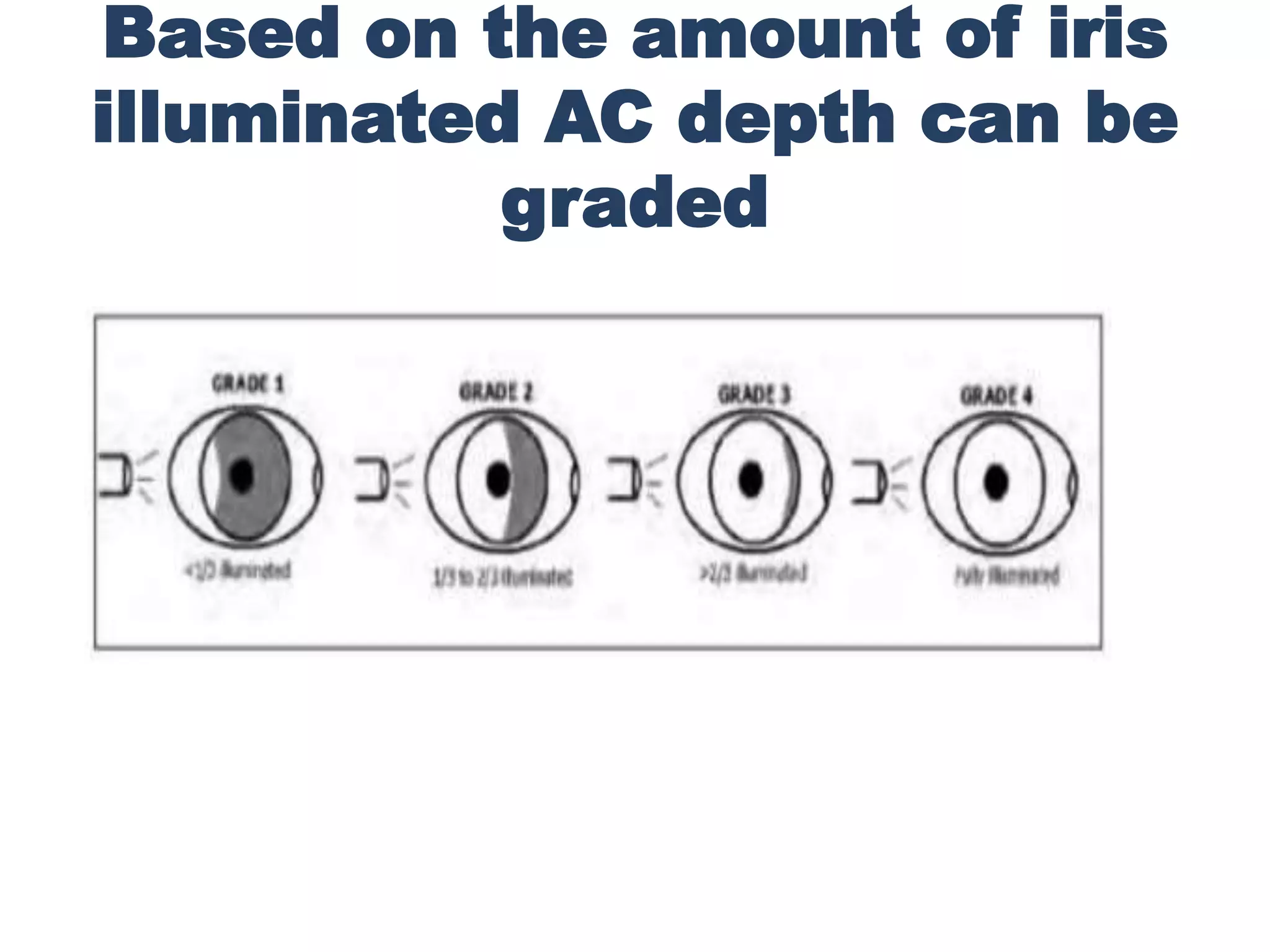Anatomy of anterior chamber angle (1) | PPTX