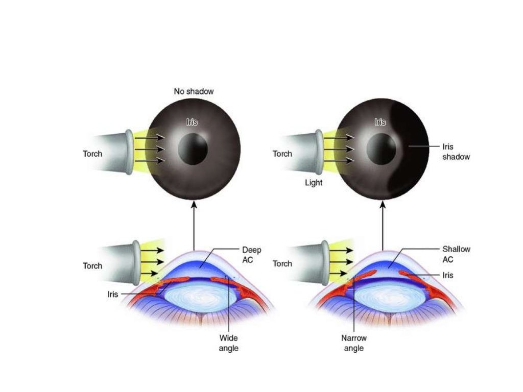 Anatomy of anterior chamber angle (1)