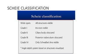 Scheie Classification System ANATOMY OF ANTERIOR CHAMBER ANGLE AND GONIOSCOPY.pptx