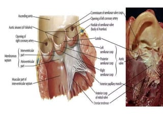 Anatomy Of Aortic Valve- Dr Garv Ameta (1).pptx