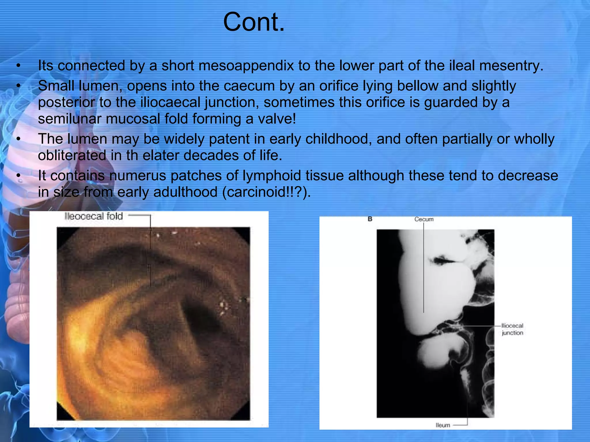 Cont. Its connected by a short mesoappendix to the lower part of the ileal mesentry. Small lumen, opens into the caecum by an orifice lying bellow and slightly posterior to the iliocaecal junction, sometimes this orifice is guarded by a semilunar mucosal fold forming a valve! The lumen may be widely patent in early childhood, and often partially or wholly obliterated in th elater decades of life. It contains numerus patches of lymphoid tissue although these tend to decrease in size from early adulthood (carcinoid!!?). 