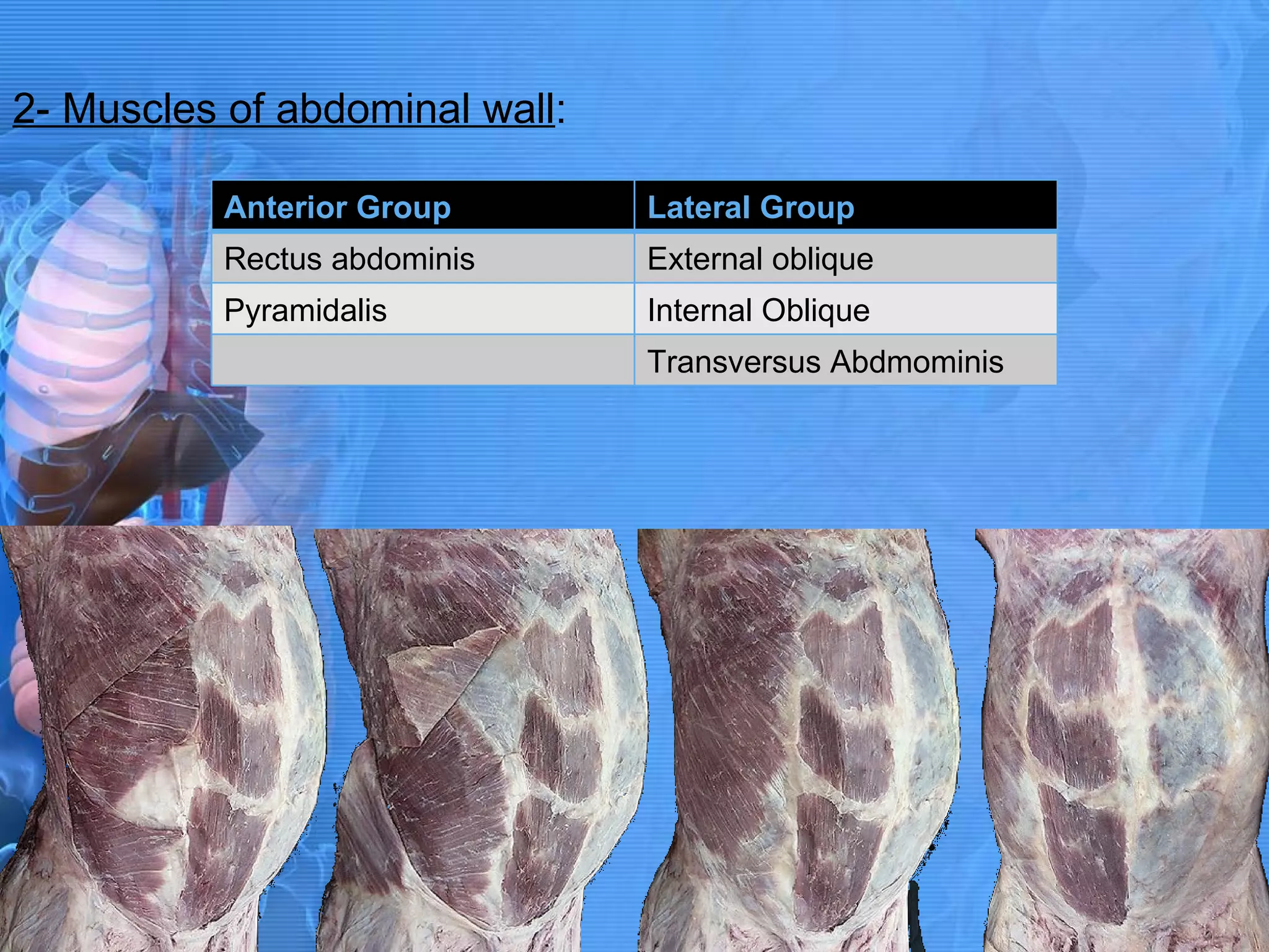2- Muscles of abdominal wall : Anterior Group Lateral Group Rectus abdominis External oblique Pyramidalis Internal Oblique Transversus Abdmominis 