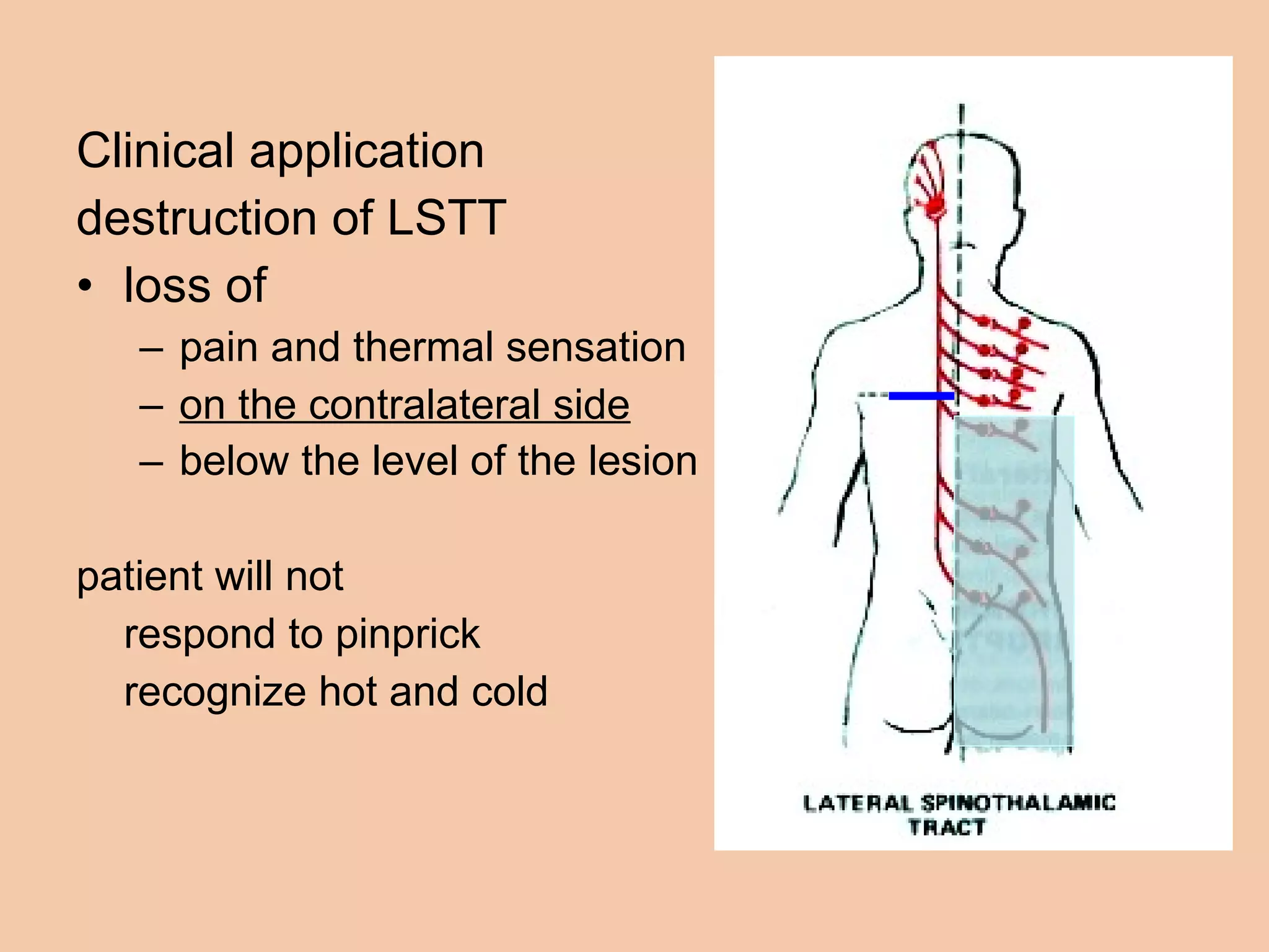 Clinical application  destruction of LSTT loss of  pain and thermal sensation  on the contralateral side below the level of the lesion   patient will not  respond to pinprick  recognize hot and cold 